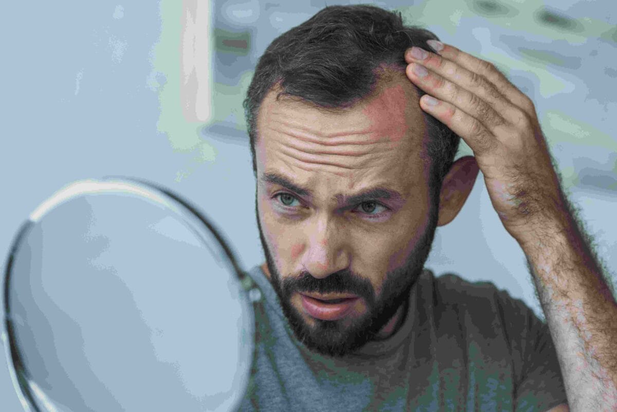 Does Testosterone Cause Hair Loss? TRT and Male Pattern Baldness