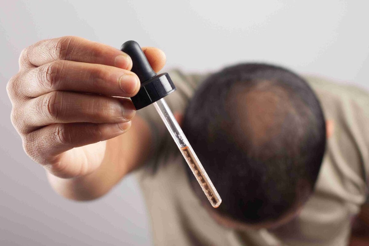 How Does Propecia Work? The Science Behind Finasteride and Hair Loss