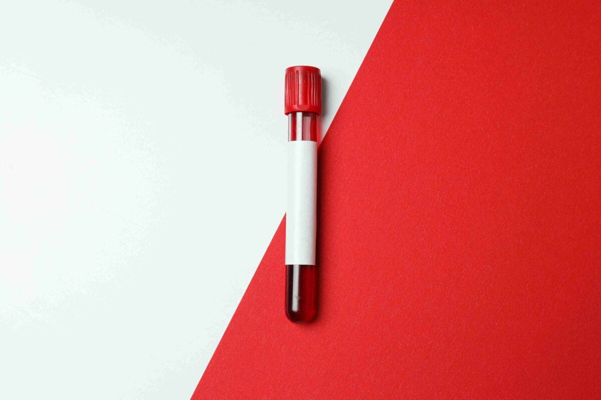 Testosterone Blood Test in the UK: What Is Measured, How to Test, and What Your Results Actually Mean