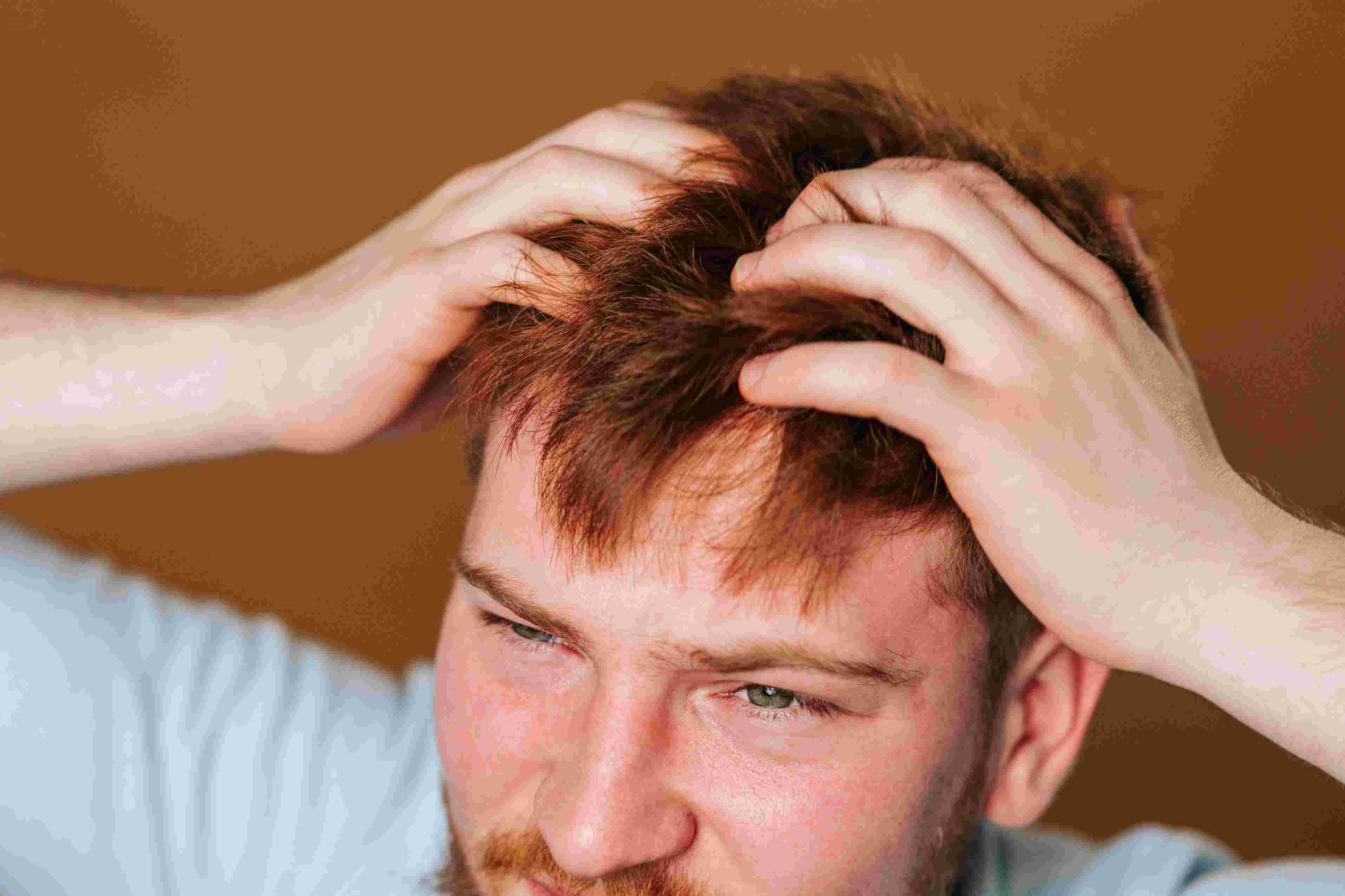 Minoxidil Side Effects: What to Expect and How to Manage Them