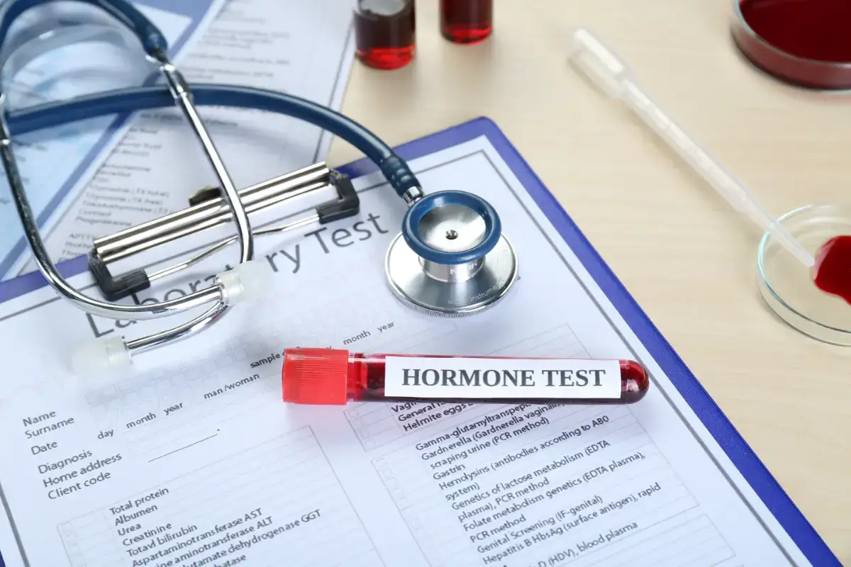 How Can I Check My Hormone Levels? A Complete Guide to Men’s Hormone Testing in the UK